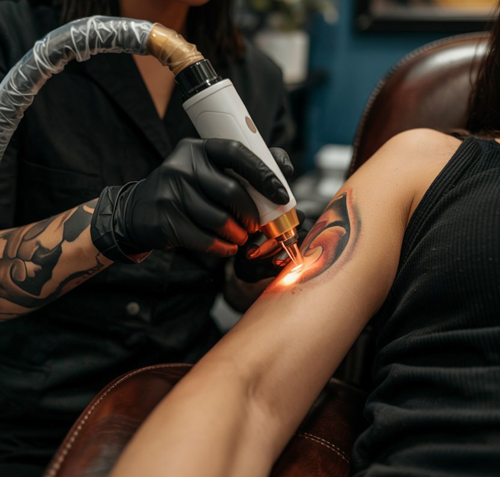 Tattoo laseren voor een cover-up: wanneer is dat slim?